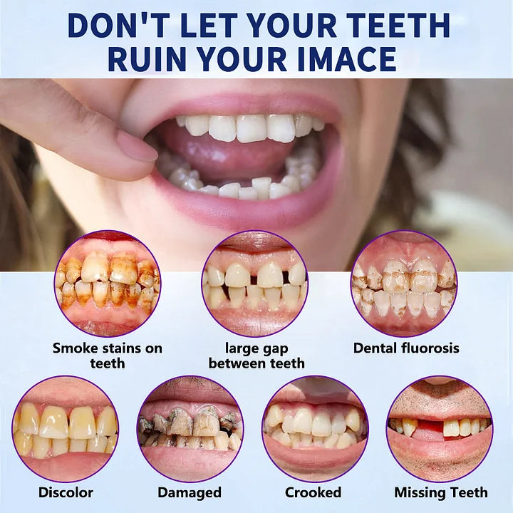 DentureSet Pro | Juego Completo de Dentaduras