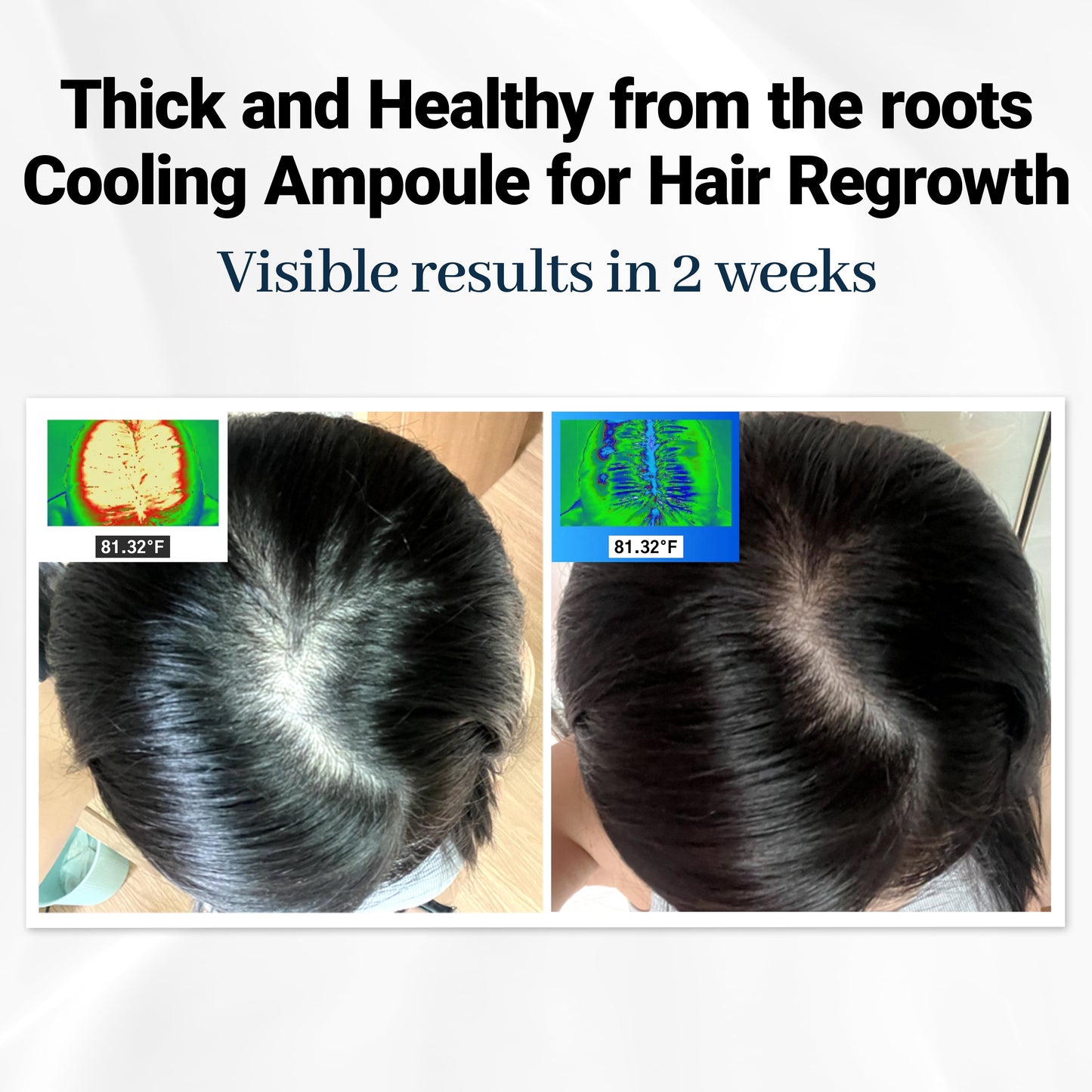 Scalpy Ampolla Refrescante para el Cabello | Salud y Crecimiento del Cuero Cabelludo