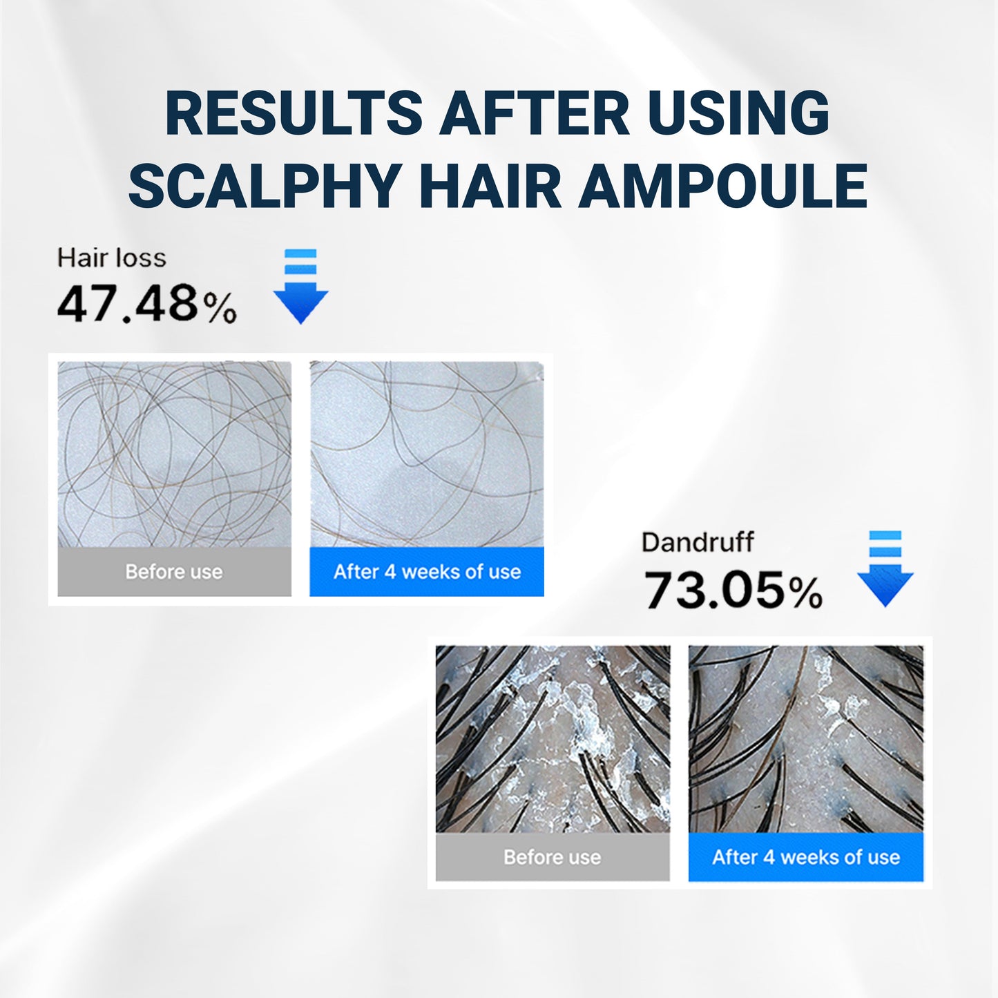 Scalpy Ampolla Refrescante para el Cabello | Salud y Crecimiento del Cuero Cabelludo