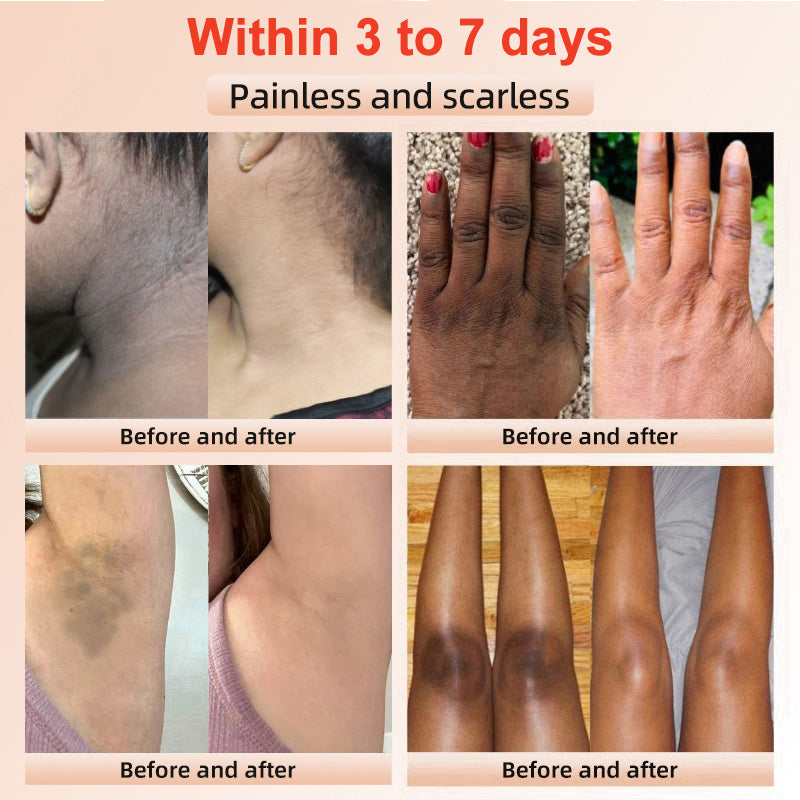 LOVILDS | Gel Exfoliante y Aclarador