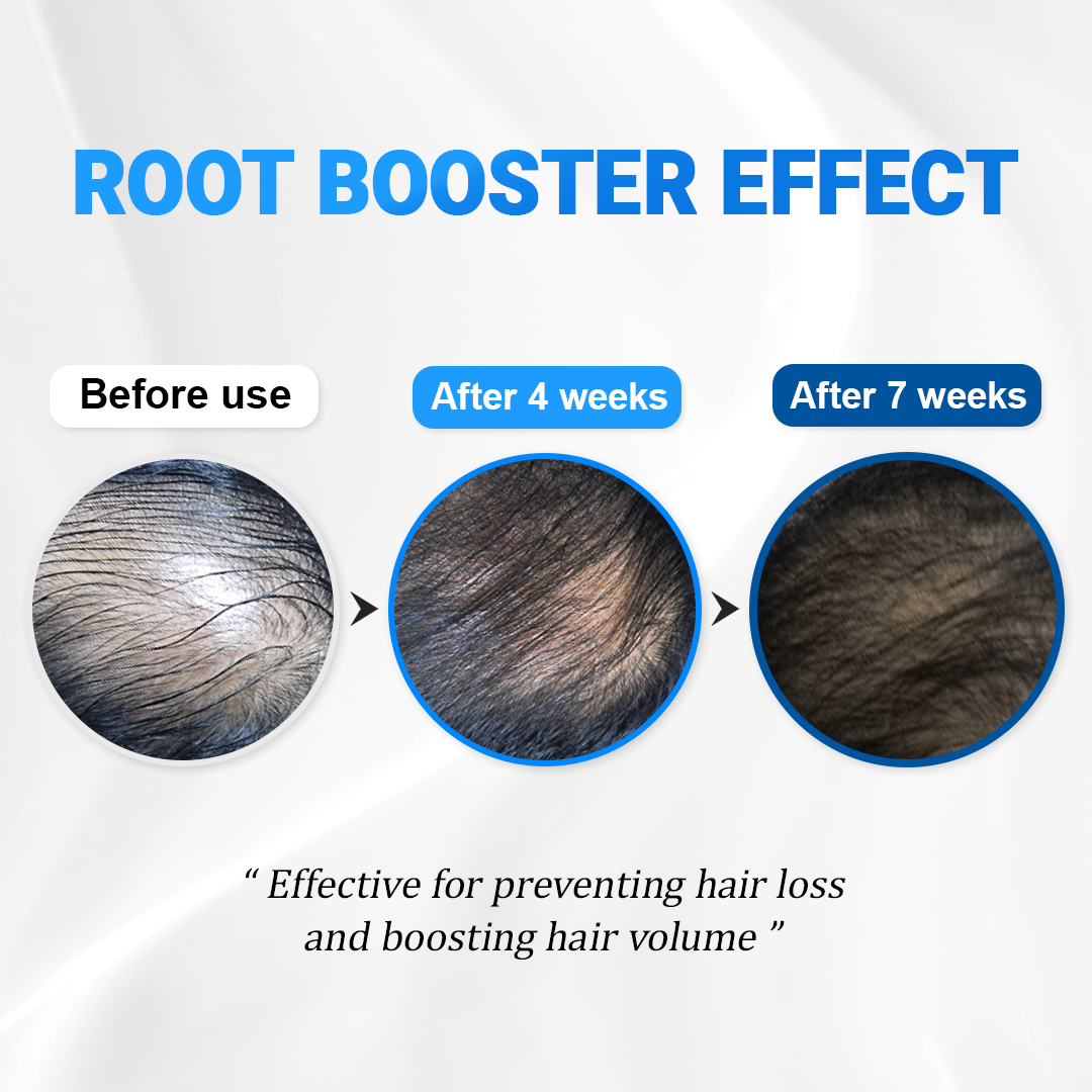 Scalpy Ampolla Refrescante para el Cabello | Salud y Crecimiento del Cuero Cabelludo