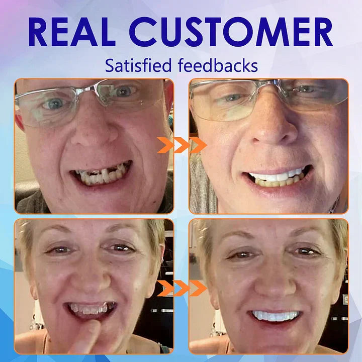 DentureSet Pro | Juego Completo de Dentaduras