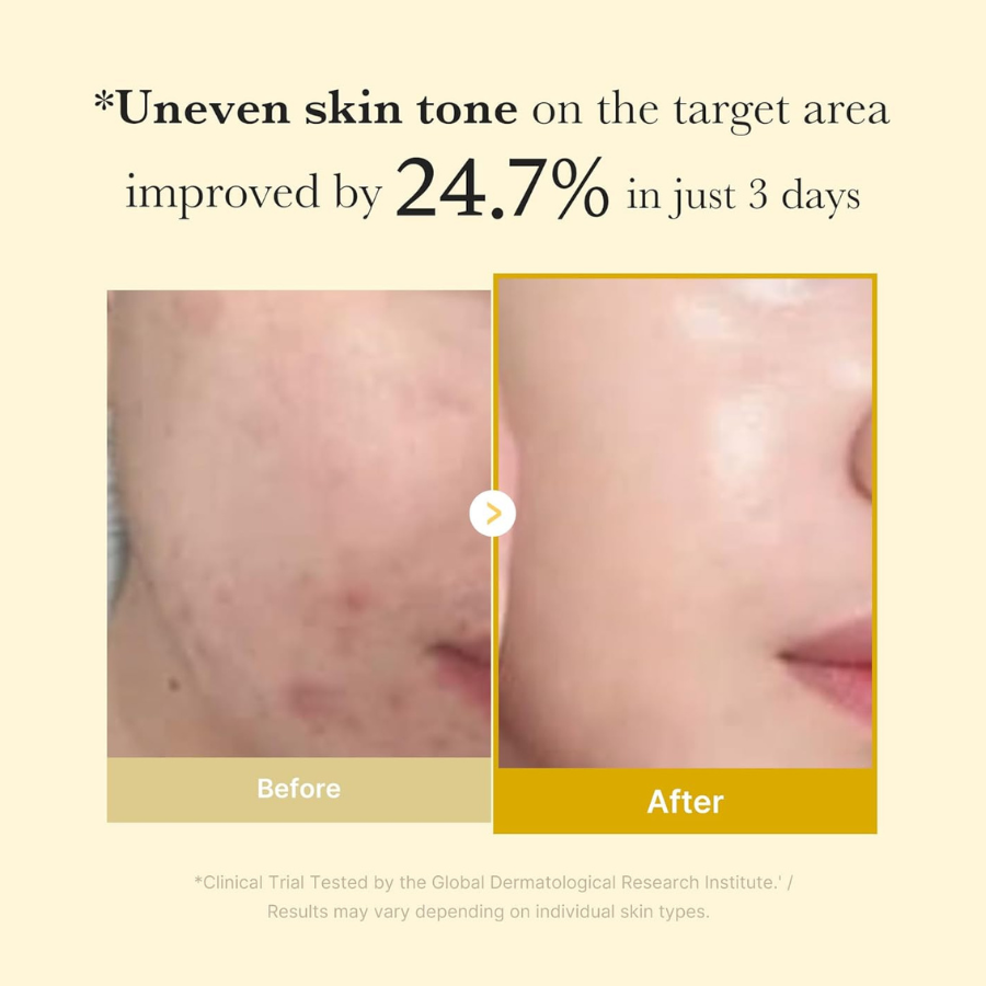 Revix | Mascarilla Peel-off para una Piel Más Brillante y Suave