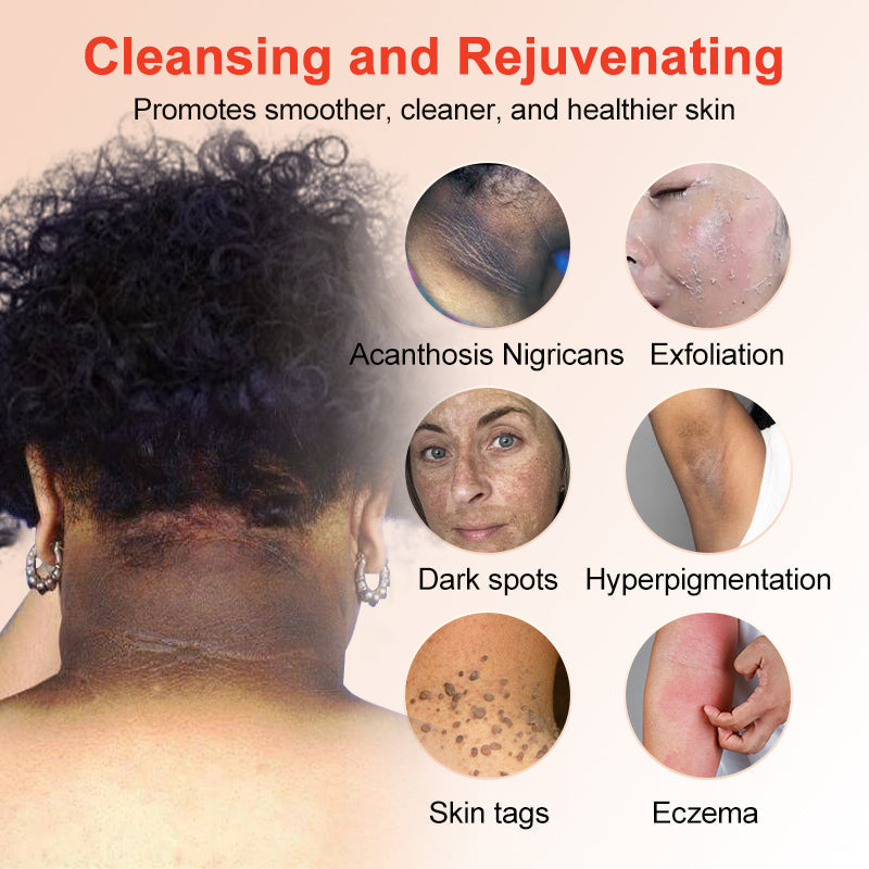 LOVILDS | Gel Exfoliante y Aclarador