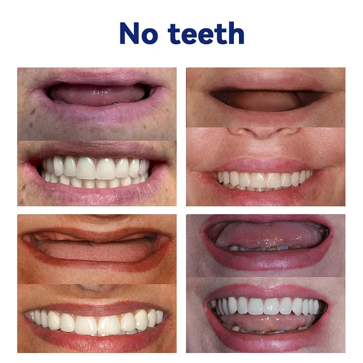 DentureSet Pro | Juego Completo de Dentaduras