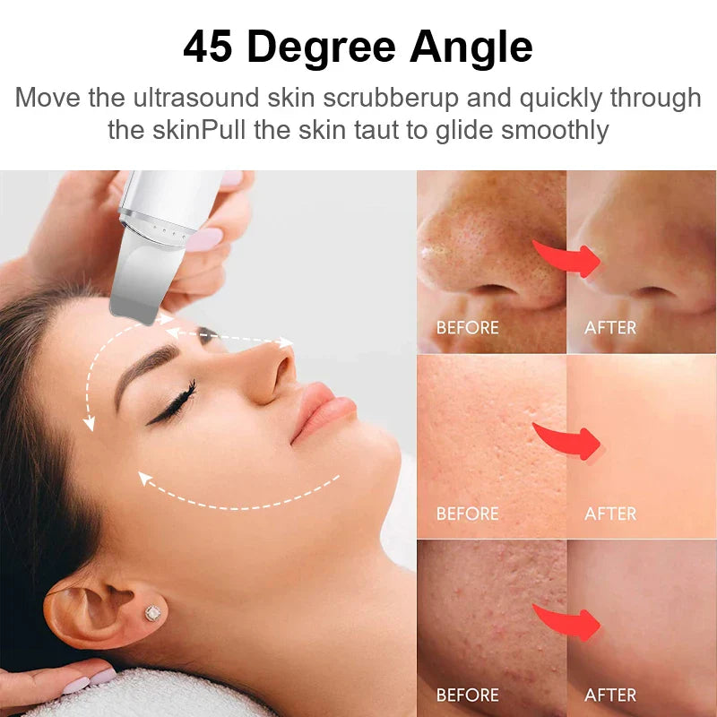 DermaWave | Limpiador de piel ultrasónico con vibración para el rostro