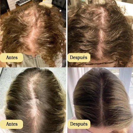 Veganic | Tratamiento de Aceite Natural para el Crecimiento del Cabello
