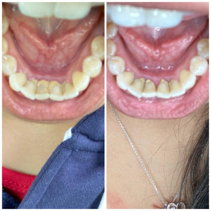 CocoNature | Enjuague Bucal de Aceite de Coco para Dientes Más Limpios