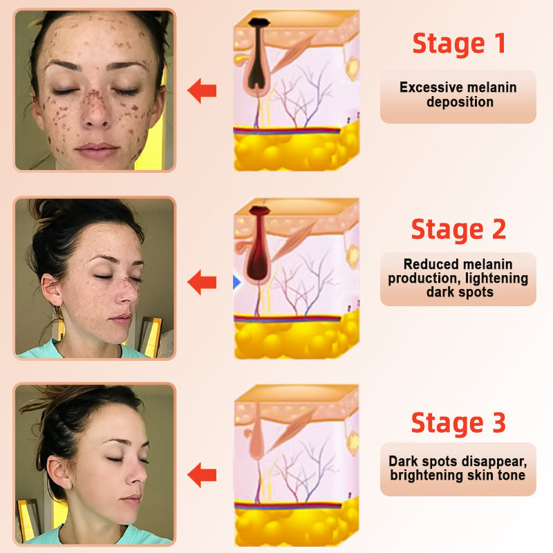 LOVILDS | Gel Exfoliante y Aclarador