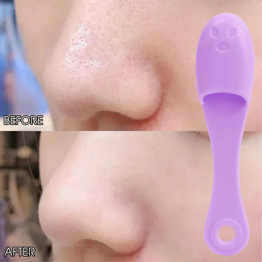 LumiScrub | Limpiador Facial de Silicona y Removedor de Puntos Negros
