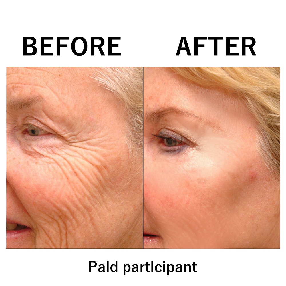 InstantLift | Crema Facial Efecto Lifting Instantáneo