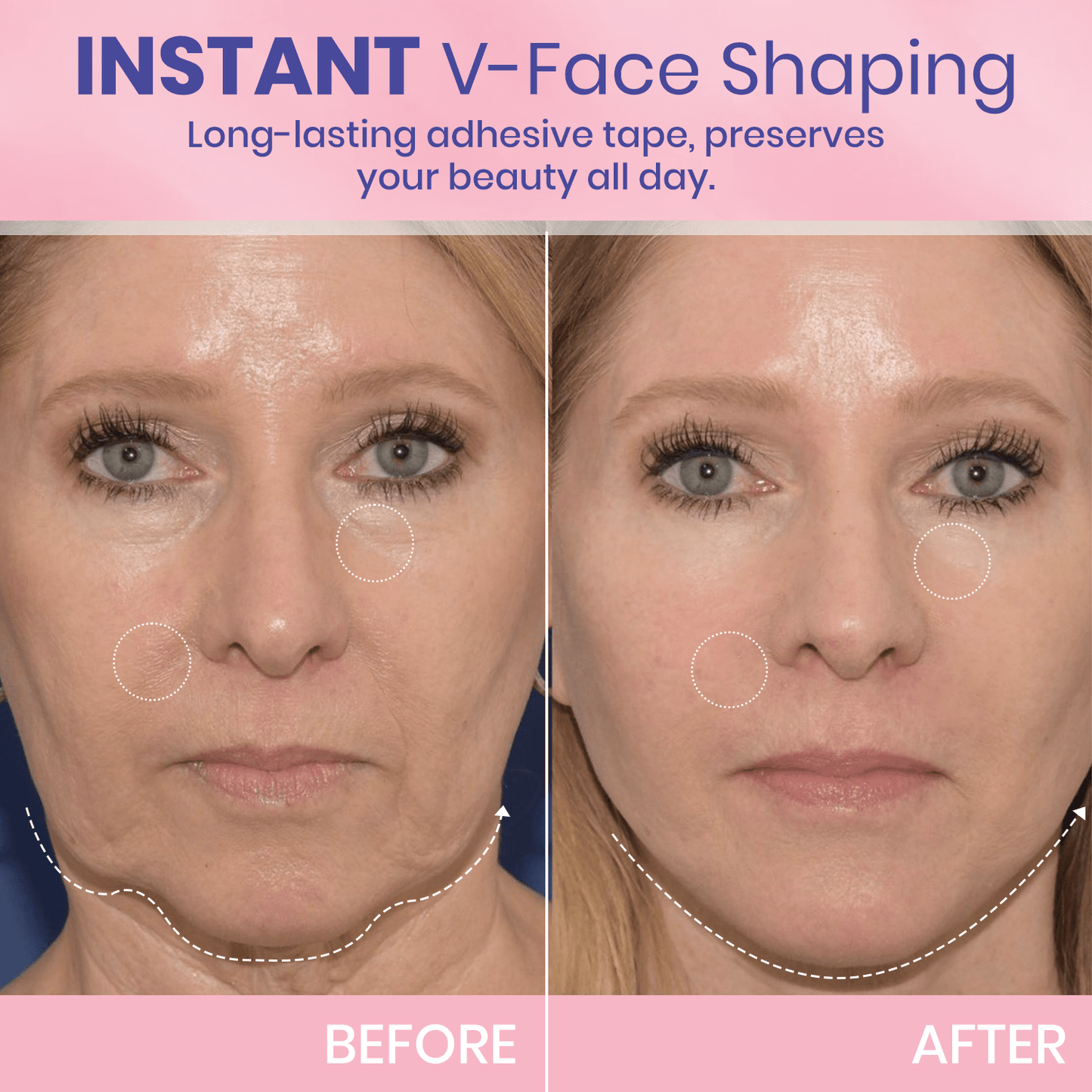 InvisiLift | Cinta Adhesiva Invisible para Lifting Facial