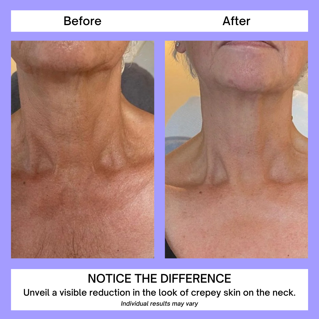 FirmNeck | Crema para Levantar el Cuello