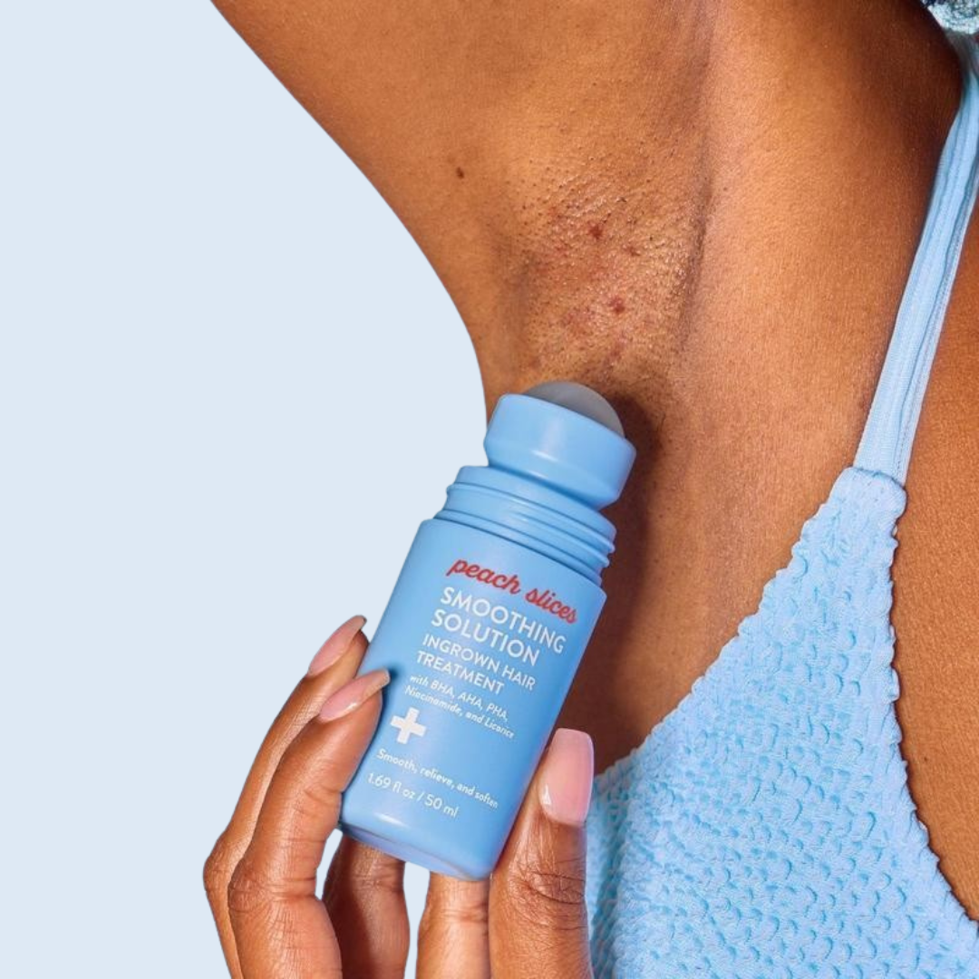 Solución Roll-On Calmante para el Tratamiento de los Pelos Encarnados