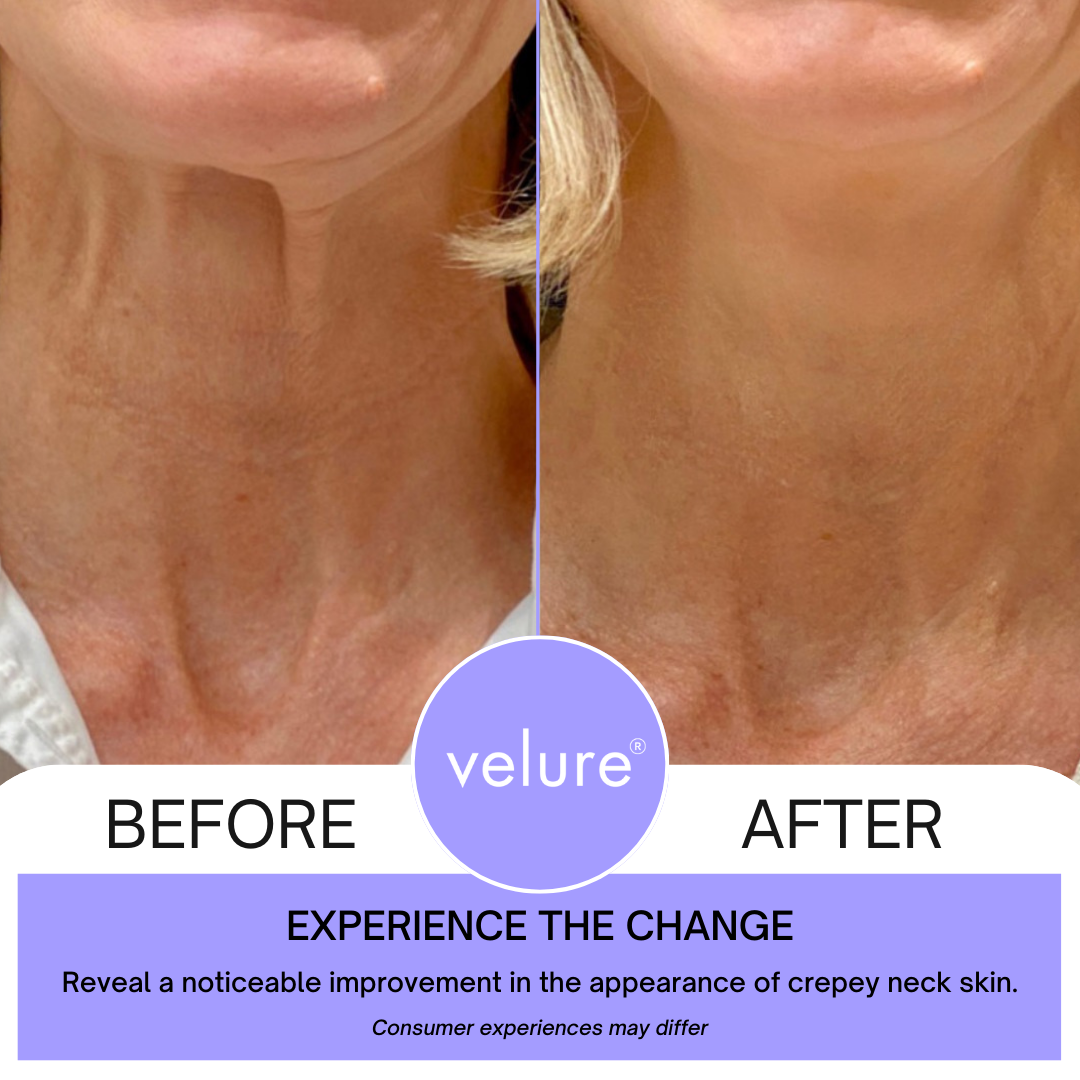FirmNeck | Crema para Levantar el Cuello