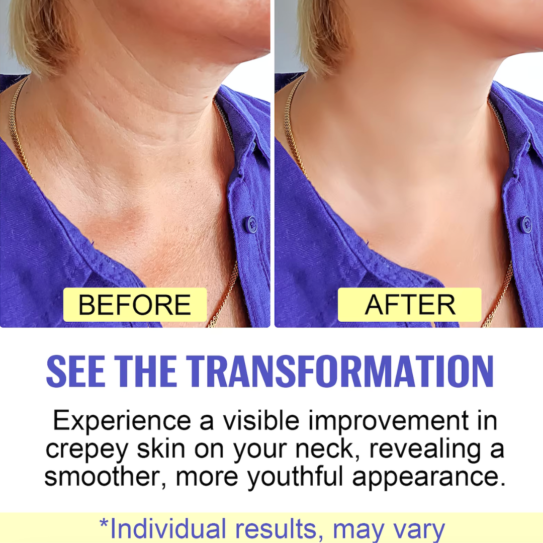 FirmNeck | Crema para Levantar el Cuello