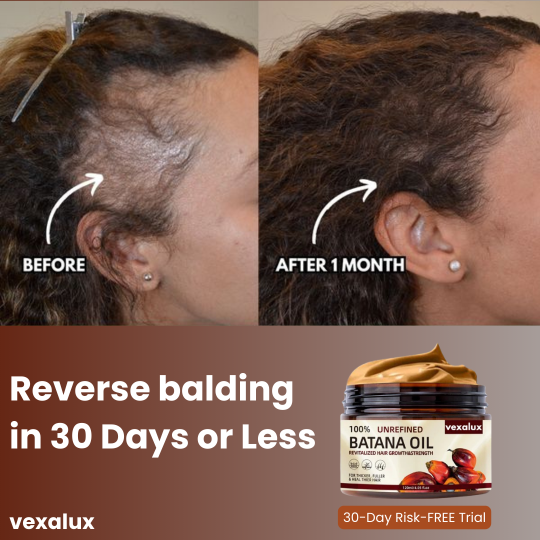 Vexalux | 100% Aceite de Batana No Refinado