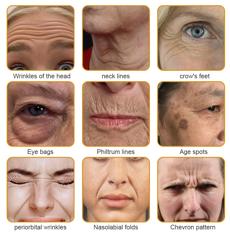 Crema BeeBotox | Crema Anti-Envejecimiento con Veneno de Abeja y Botox