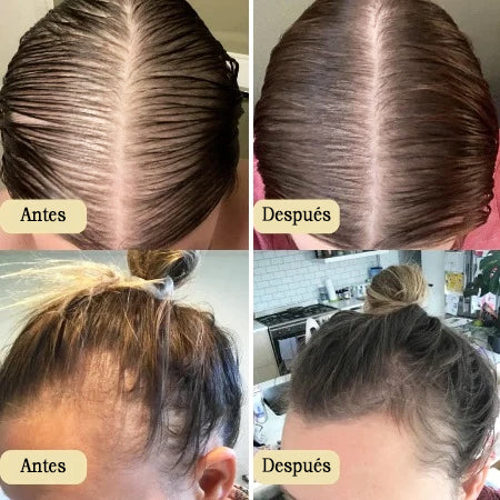 Veganic | Tratamiento de Aceite Natural para el Crecimiento del Cabello