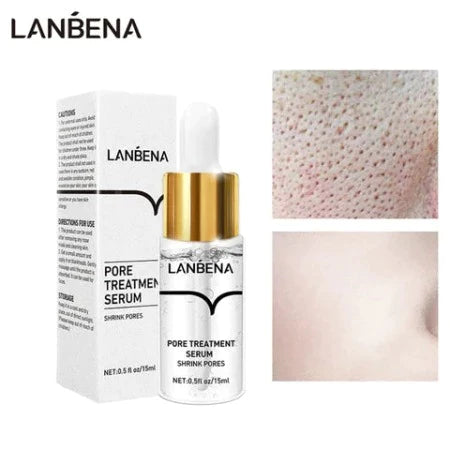 LANB́ENA™ | Mascarilla para Puntos Negros