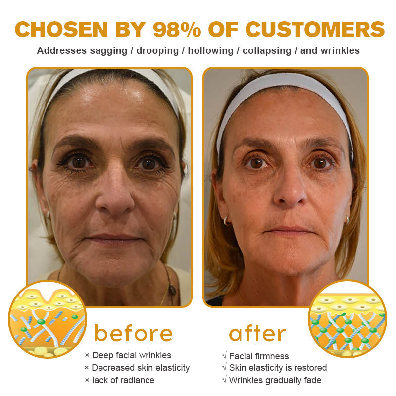 Crema BeeBotox | Crema Anti-Envejecimiento con Veneno de Abeja y Botox